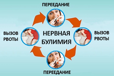 Лечение булимии в Красном Чикое